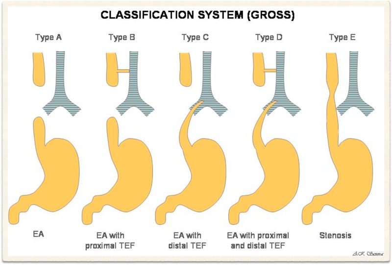 gastric cancer treatment uk