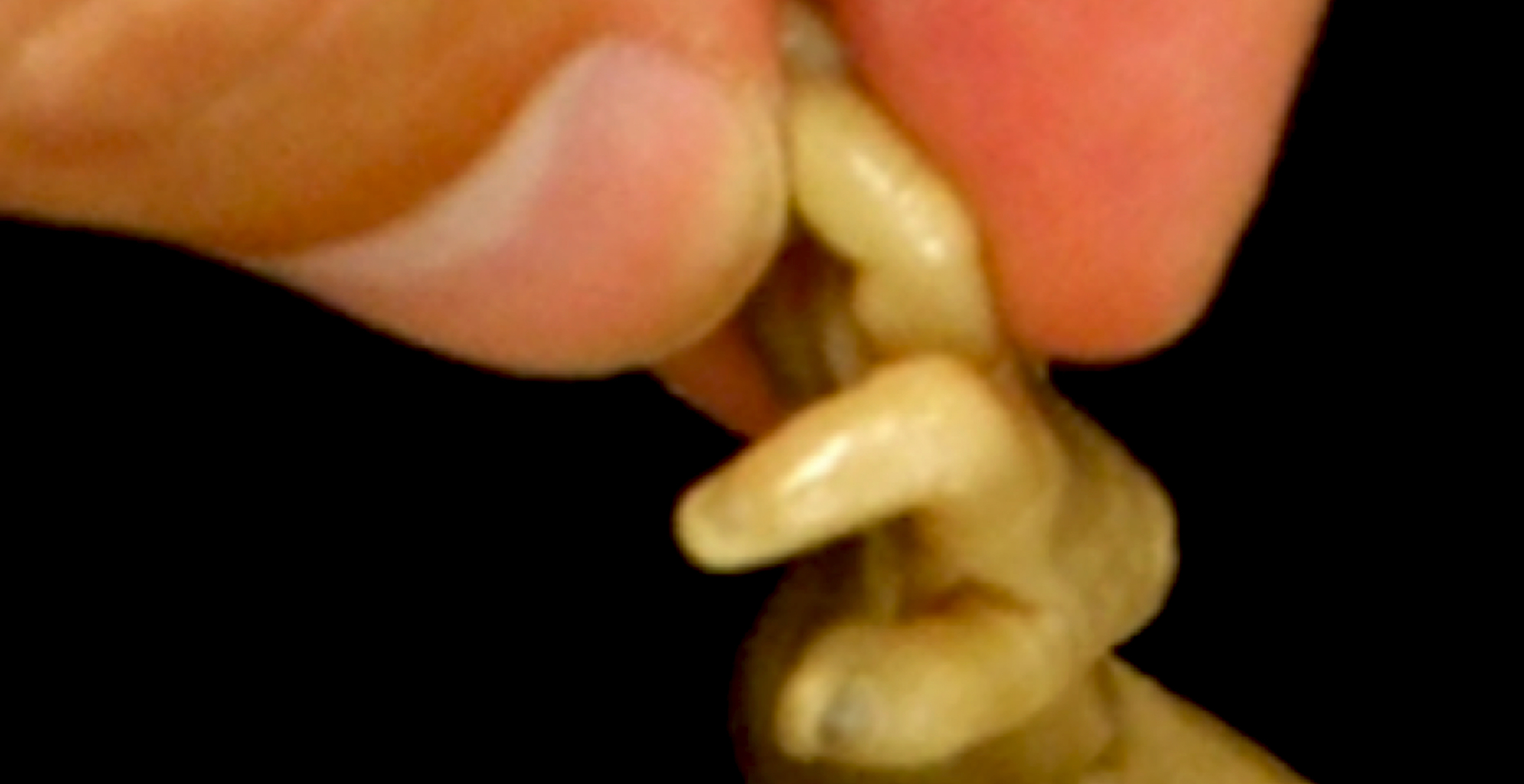 "holding hands with a plastinated fetus"